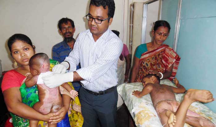 আগৈলঝাড়া হাসপাতালে আগুনে পোড়ার রোগীদের চিকিৎসা আগৈলঝাড়া হাসপাতালে আগুনে পোড়ার রোগীদের চিকিৎসা