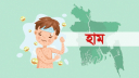 হাম উপসর্গে আরও ৪ শিশুর মৃত্যু