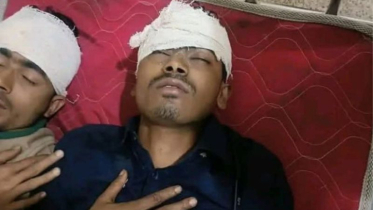 হাতিয়ায় দায়িত্ব পালনকালে বিটিভির সাংবাদিককে কুপিয়ে জখম