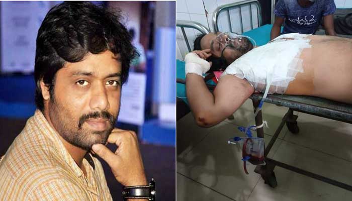 বাসচাপায় গুরুতর আহত সাংবাদিক ইকরাম : ভেঙেছে পাঁজরের হাড় বাসচাপায় গুরুতর আহত সাংবাদিক ইকরাম : ভেঙেছে পাঁজরের হাড়