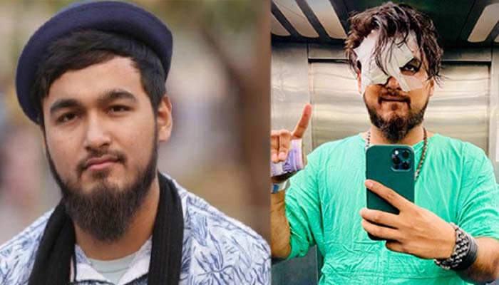 সড়ক দুর্ঘটনায় গুরুতর আহত নোবেল :মাথায় ৩০ সেলাই সড়ক দুর্ঘটনায় গুরুতর আহত নোবেল :মাথায় ৩০ সেলাই