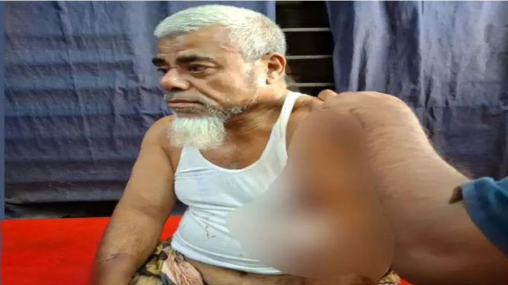 ঠাকুরগাঁওয়ে ব্যবসায়ীকে কুপিয়ে ৮ লাখ টাকা ছিনতাই ঠাকুরগাঁওয়ে ব্যবসায়ীকে কুপিয়ে ৮ লাখ টাকা ছিনতাই